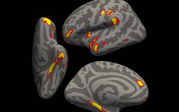 Nghiên cứu mới giải mã bí ẩn 'sương mù não' hậu Covid-19