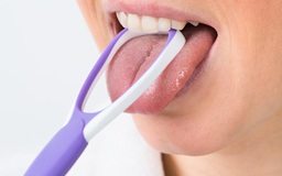 Có nên vệ sinh lưỡi khi đánh răng?