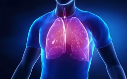 Ho và ung thư phổi có liên quan với nhau không?