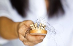 5 lý do khiến tóc mỏng đi có thể khiến bạn bất ngờ