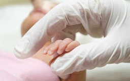 Vì sao trẻ sơ sinh mắc thủy đậu dễ bị biến chứng nguy hiểm?