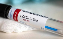 Phát hiện một người nhiễm Covid-19 nhẹ vẫn dương tính suốt 221 ngày