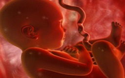 Phát hiện bào thai bên trong cậu bé 4 tuổi