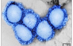 Phát hiện virus mới giống SARS có thể lây từ dơi sang người