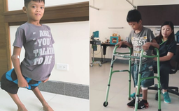Cậu bé có 'đôi chân hồng hạc' được phẫu thuật đổi đời