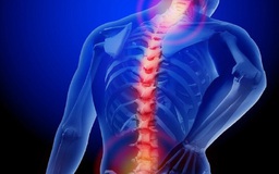 Những cơn đau lưng nào bắt buộc phải đi khám bác sĩ?