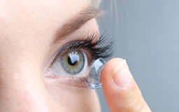 5 cách trị mắt đỏ do khô, viêm nhiễm tại nhà