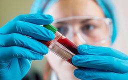 Xét nghiệm máu đơn giản có thể phát hiện 7 loại ung thư nguy hiểm