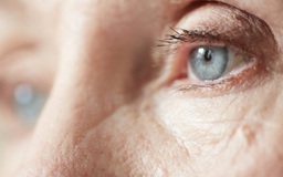 4 dấu hiệu thầm lặng của nhiễm trùng mắt nguy hiểm
