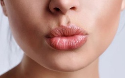 Lợi ích sức khỏe đáng kinh ngạc của nụ hôn