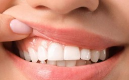 4 bệnh có thể xuất hiện dấu hiệu ở răng