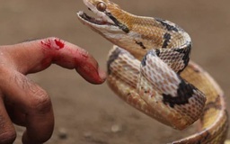 Bị rắn độc cắn, dùng miệng hút tại vết thương có an toàn không?