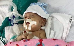 Chung tay giúp cháu bé sinh non mắc bệnh xơ phổi
