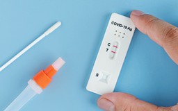 Bao lâu sau khi tiếp xúc với F0 thì test có kết quả chính xác?