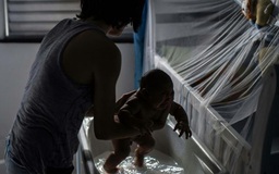 Vi rút Zika có thể hủy hoại mắt của trẻ