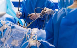 Phẫu thuật robot điều trị ung thư thực quản