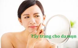 Sản phẩm tẩy trang nào phù hợp với làn da nhờn mụn?