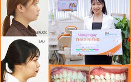 Nơi niềng răng uy tín TP.HCM: 5 tiêu chí đánh giá có thể bạn chưa biết