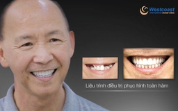 Khắc phục hậu quả trồng răng implant thất bại