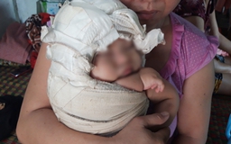 Thực hư bác sĩ bị tố khiến bé gái sơ sinh 4,1kg 'đứt dây chằng cánh tay'