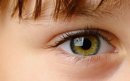 Chẩn đoán chứng tự kỷ ở trẻ qua mắt