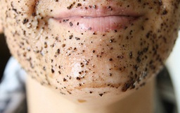 Cẩm nang chăm sóc da nhờn - Kỳ 2: Những điều cần lưu ý khi chăm sóc da nhờn bằng mỹ phẩm