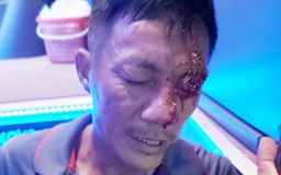 Nổ súng tại bến xe Quy Nhơn: Hung thủ chĩa súng vào mắt nạn nhân để bắn