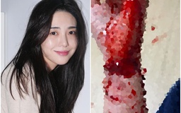 Mina đăng ảnh cắt cổ tay, dằn mặt thành viên AOA và chủ cũ