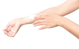 Cách chăm sóc da sau khi tiếp xúc với ánh nắng