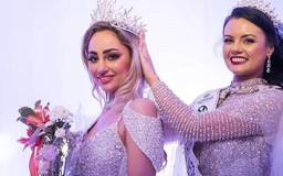 Hoa hậu Hà Lan từ chối thi Miss World vì yêu cầu phải tiêm vắc xin