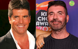 Simon Cowell ngưng tiêm botox, filler vì gương mặt trở nên 'kỳ dị'