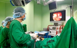 Cùng lúc phẫu thuật cắt túi mật và lấy sỏi ống mật chủ cho bệnh nhân