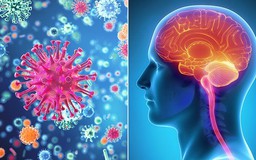 3 dấu hiệu nhận ra bệnh viêm màng não nguy hiểm chết người