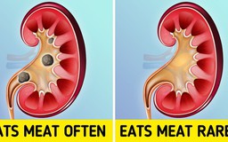 Điều gì sẽ xảy ra với cơ thể nếu bạn chỉ thích ăn thịt?