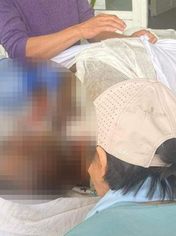 Ninh Thuận: Cha dùng xăng đốt nhà, con 1 tháng tuổi tử vong