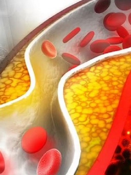 Cân nặng ảnh hưởng đến huyết áp thế nào?