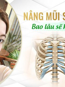 Nâng mũi cấu trúc Sụn sườn Fascia bao lâu hết sưng ?