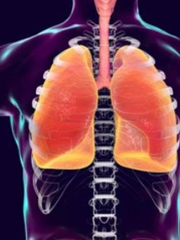 Viêm phổi tăng ở trẻ em nhiều nước: Các triệu chứng cần chú ý