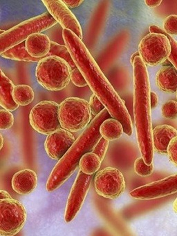 Viêm phổi tăng ở trẻ em nhiều nước: Cảnh giác với vi khuẩn mycoplasma