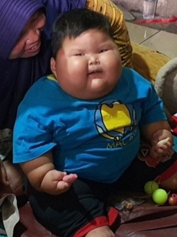 Chuyện lạ: Em bé 16 tháng tuổi đã nặng 27 kg