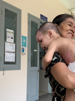 Vụ bé trai 2 tuổi bị bạo hành: 'Thương vô cùng khi thấy cháu đau đớn!'