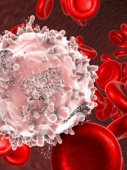 Ngày mới với tin tức sức khỏe: Dấu hiệu trên da cảnh báo ung thư máu