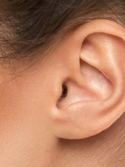 Xuất hiện cục u sau vành tai, khi nào cần phải lo lắng?