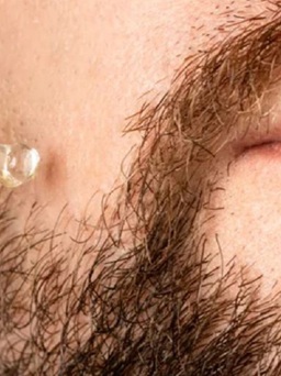 Không vệ sinh râu ảnh hưởng ra sao đến sức khỏe?