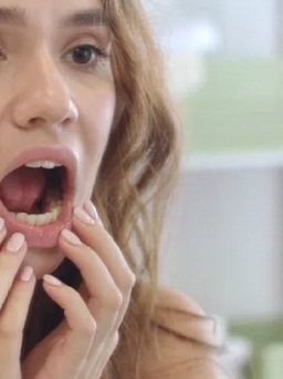 Nhổ răng: Cần làm gì để vết thương mau lành?
