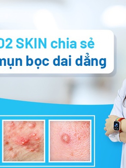 Mụn bọc dai dẳng, nguyên nhân và cách điều trị đúng