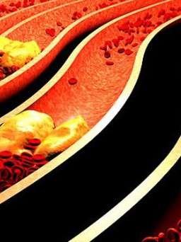 3 món ăn sáng giúp giảm mức cholesterol cao