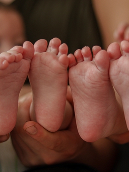 Hiện tượng 'siêu thai': Mẹ thụ thai 2 lần cách nhau 18 ngày, sinh 2 con cùng lúc
