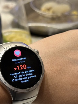 Smartwatch dần chiếm ưu thế so với đồng hồ truyền thống