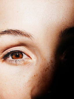 Các loại ung thư có thể biểu hiện dấu hiệu bất thường ở mắt